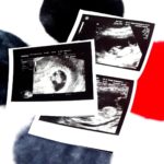 Kalendarz ciąży – miesiąc pierwszy